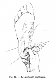Ec pied 15