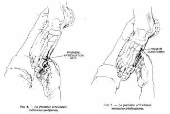 Ec pied 4