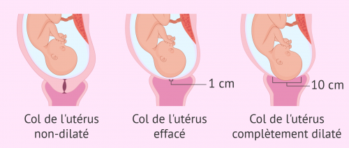 Effacement et dilation du col de luterus pendant laccouchement