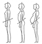 Grossesse posture