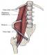 Ilio psoas