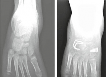 Me tatarsus photo 3