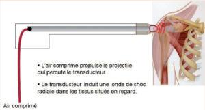Production dune odc radiales 300x161