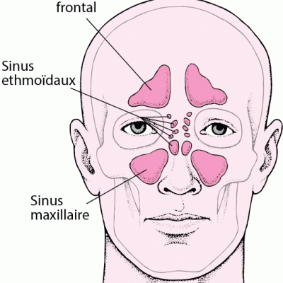 Sinusite : causes, symptômes & traitements